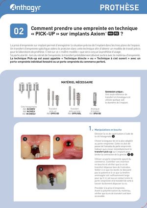 Prise d'empreinte PICK-UP sur Axiom® REG/PX