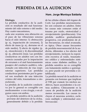 Perdida Audicion