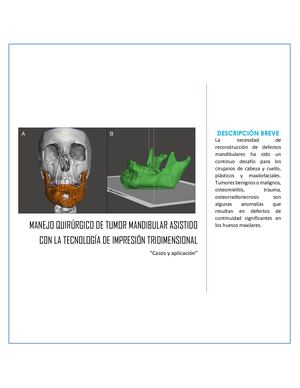 MANEJO QUIRÚRGICO DE TUMOR MANDIBULAR ASISTIDO CON LA TECNOLOGÍA DE IMPRESIÓN TRIDIMENSIONAL