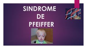Síndrome de Pfeiffer