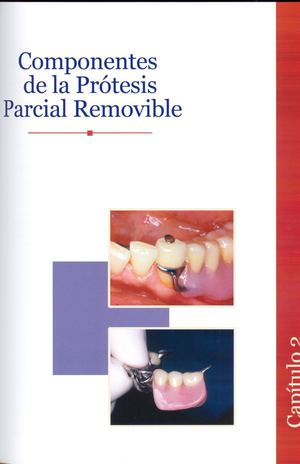 Componentes de la Prótesis Parcial Removible