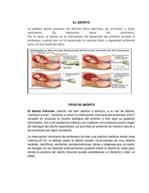 El Aborto