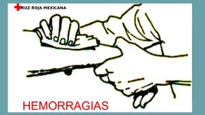 Hemorragias