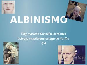 Albinismo