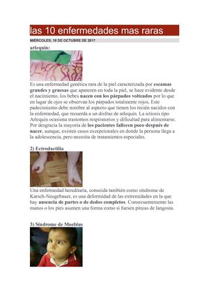 Las 10 Enfermedades Mas Raras