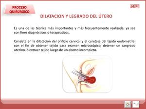 DILATACION Y CURETAJE