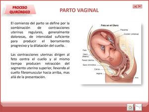 PARTO VAGINAL