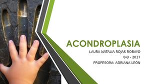 Acondroplasia