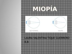 Miopía