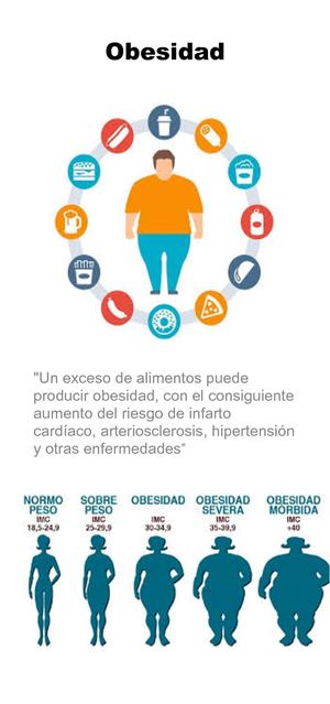 Obesidad