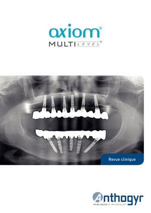 Revue clinique Axiom® Multi Level®