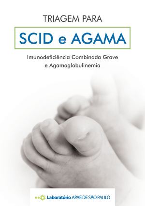 Teste do Pezinho - SCID Agama