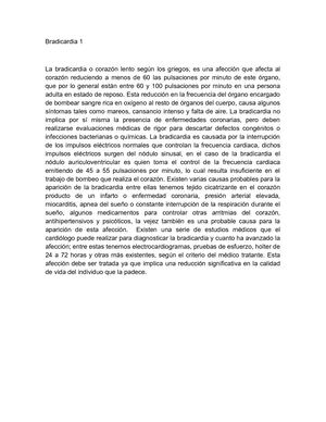 Bradicardia