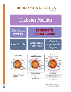 Sintesis Retinopatía Diabética