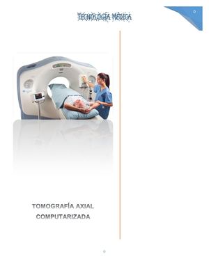 TOMOGRAFÍA AXIAL COMPUTARIZADA