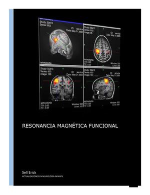 Resonancia magnética funcional