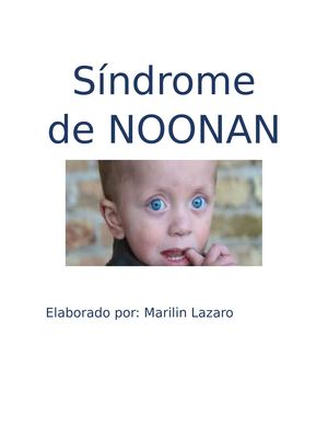 Síndrome De Noonan