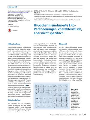 09 Hypothermieinduzierte EKG Veränderungen Charakteristisch, Aber Nicht Spezifisch
