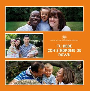 sindrome de down en bebes