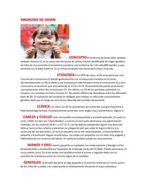 síndrome de down