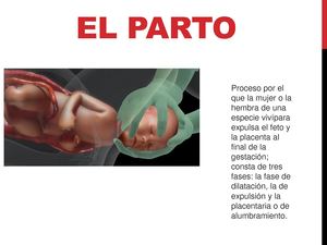 El Parto