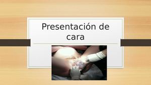 Presentación De Cara