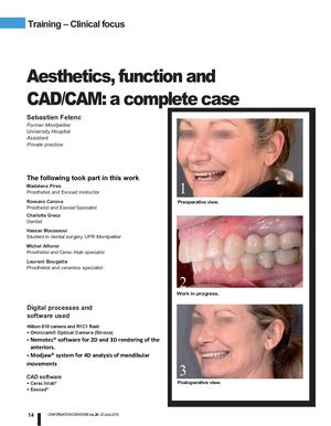 Aesthetic & Funtion A Complete Case With Modjaw