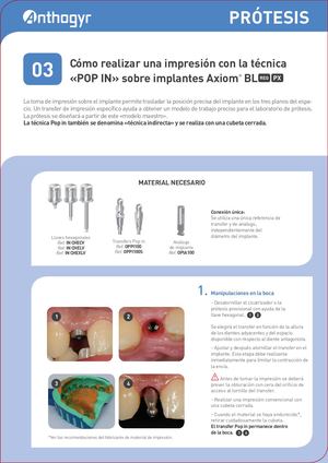 Cómo realizar una impresión con la técnica «POP IN» sobre implantes Axiom®BL