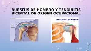 Bursitis Y Tendinitis