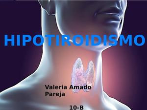 Portafolio Hipotiroidismo Valeria Amado Pareja 10 B