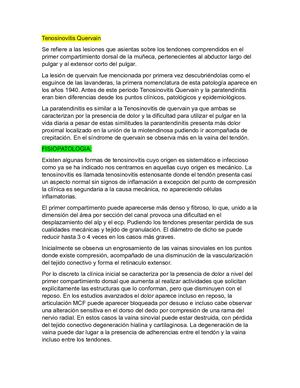 Tenosinovitis Quervain