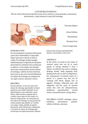 Cáncer de estómago