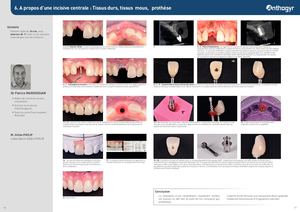 Cas AxIN® n° 6 - Dr Margossian