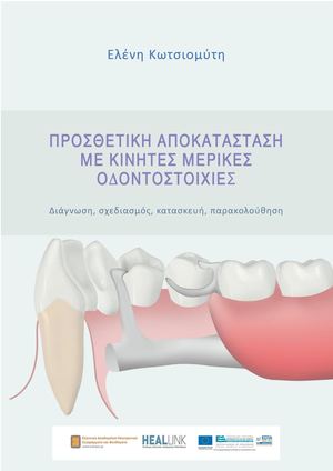 Προσθετική αποκατάσταση με κινητές μερικές οδοντοστοιχίες.