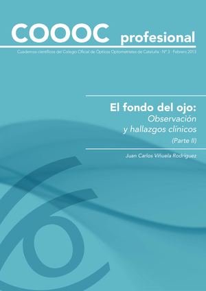 Cuaderno científico 3 - El fondo del ojo (2)
