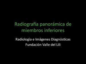 Adquisión Y Posicionamiento En Panoramica De Ms Is Diego