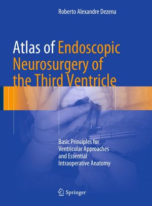 Atlas Of Endoscopic Neurosurgery Of The Third Ventricle Basic Principles For Ventricular Approaches And Essential Intraoperative Anatomy 2017