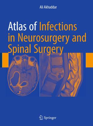 Atlas Of Infections In Neurosurgery And Spinal Surgery 2017