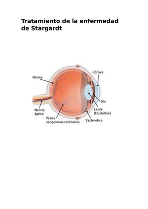 Tratamiento De La Enfermedad De Stargardt