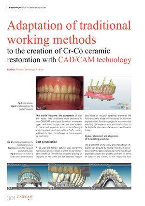 Adaptation of traditional working methods to the creation of Cr-Co ceramic restoration with CAD/CAM technology