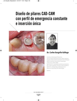 Diseño de pilares CAD-CAM con perfil de emergencia constante e inserción única - Dr Gargallo