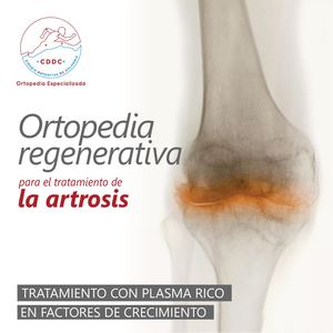 Catalogos Cddc Ortopedia Regenerativa La Artrosis Pdf1