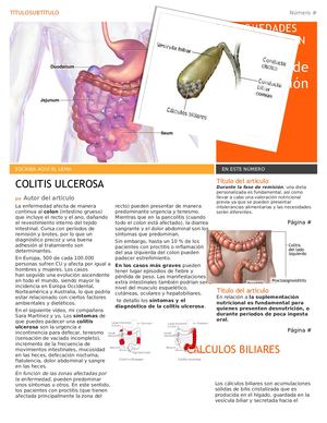 Colitis ulcerosa dieta pdf Colitis ulcerosa dieta pdf