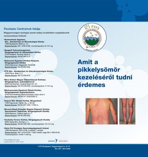 Psoriasis Brossura 2018