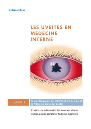 Les Uveites en médecine Interne