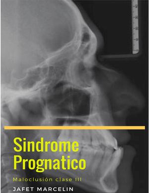 Síndrome Prognatico