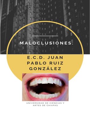 agenesia dental causante agenesia dental causante