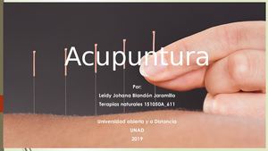 Acupuntura