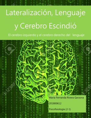 Lateralizacion