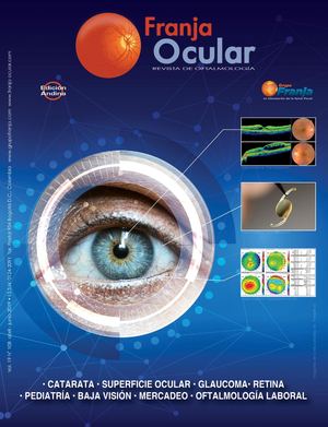 Franja Ocular 108